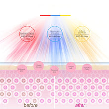 Load image into Gallery viewer, CharmBella™ LED Skin Therapy Mask