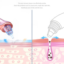 Load image into Gallery viewer, CharmBella™ Pore Cleanser