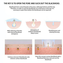 Load image into Gallery viewer, CharmBella™ Pore Cleanser